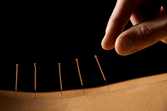 Sabine Frau Hünten Praxis acupuncture - photo 1