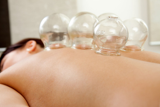 Sabine Frau Hünten Praxis acupuncture - photo 3